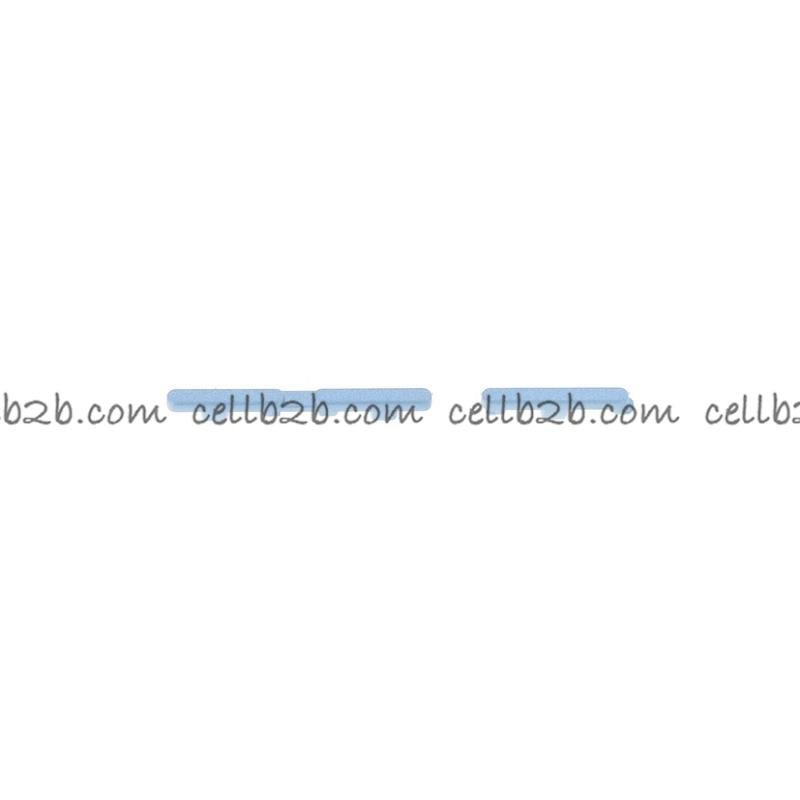 Botones Laterales Para Motorola Edge 40 XT2303-2 Azul